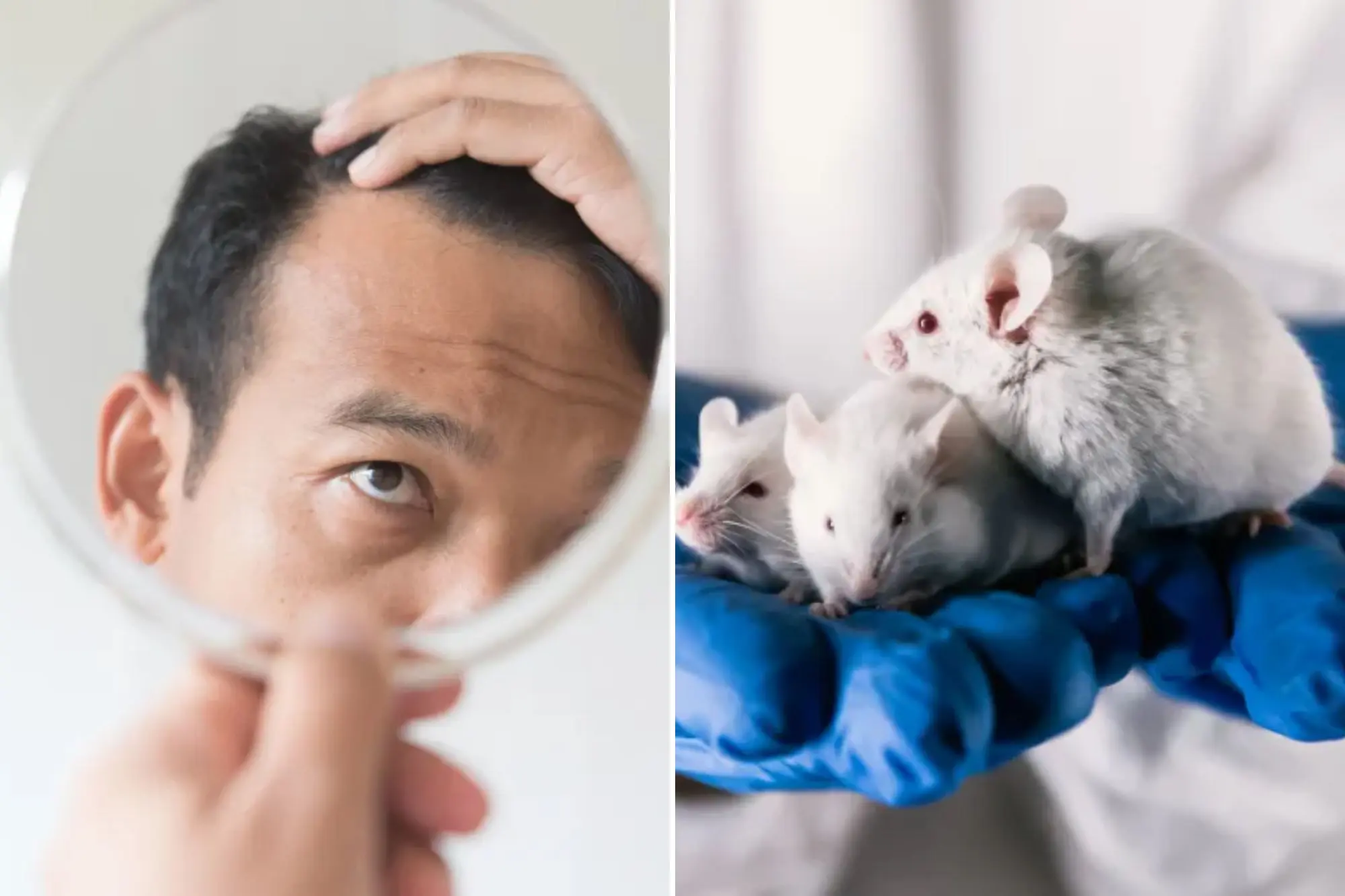 Breakthrough Hair Loss Cure: 100% of Male Mice Regrew Fur with New Stem Cell Treatment